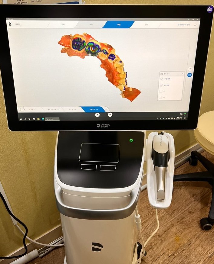 디지털 구강스캐너 화면